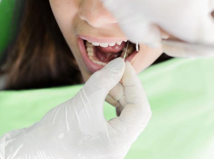 Expert Endodontist Specialists in Kennesaw, Georgia