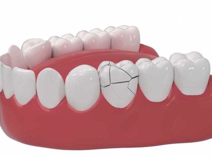 Manage pain and preserve your oral health with dental trauma treatment